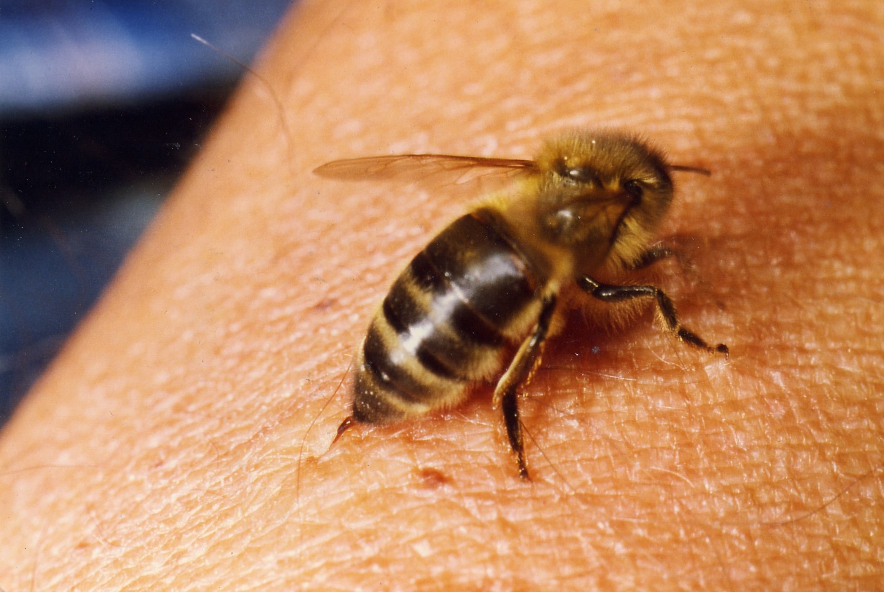 Comment dois-je réagir à une piqûre d’abeille